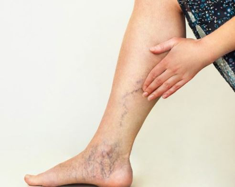 Slider image (4) Dr. Dagim Leykuns - Vascular Practice